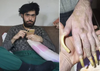 Türkiye’nin konuştuğu Barış’ın son hali! 25 yaşını kutladı, türkü bile söyledi